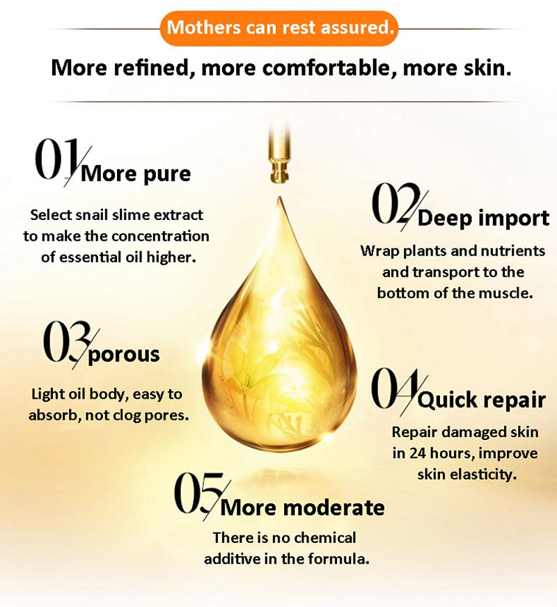 EELHOE ACEITE ESENCIAL REPARADOR  DE ESTRIAS 20ML. HIDRATANTE Estrías 20ml.