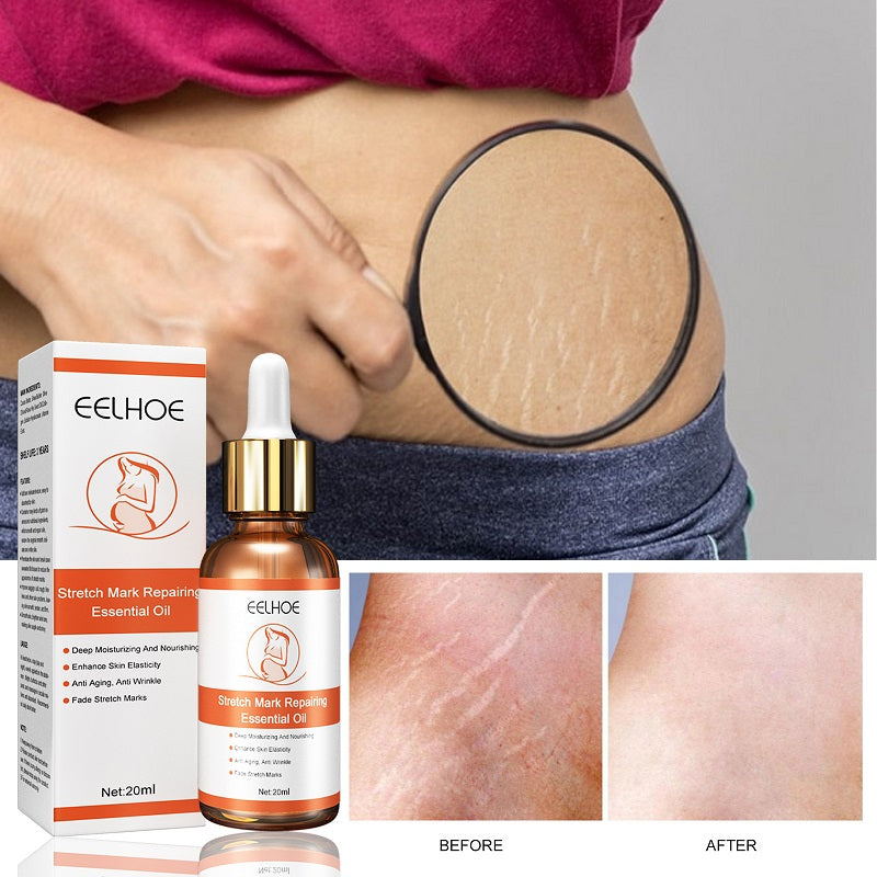 EELHOE ACEITE ESENCIAL REPARADOR  DE ESTRIAS 20ML. HIDRATANTE Estrías 20ml.