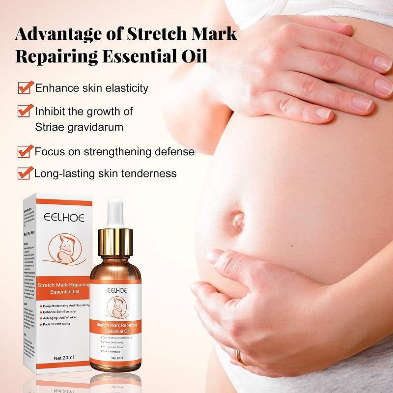EELHOE ACEITE ESENCIAL REPARADOR  DE ESTRIAS 20ML. HIDRATANTE Estrías 20ml.